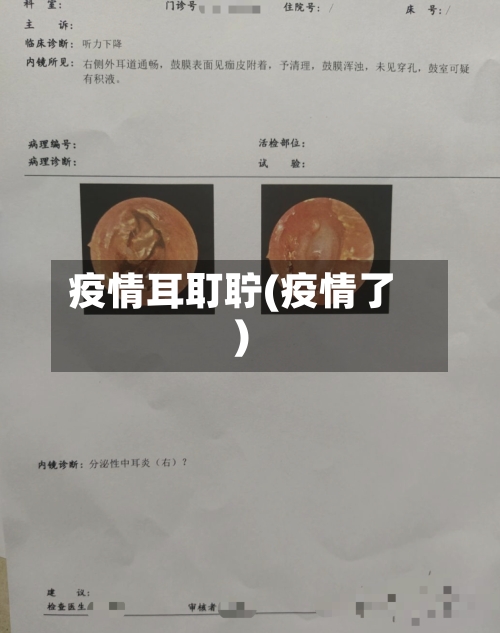 疫情耳耵聍(疫情了)-第2张图片